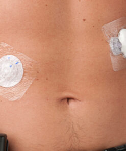 Close-up showing Tegaderm edges sealed on skin