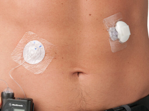 Close-up showing Tegaderm edges sealed on skin